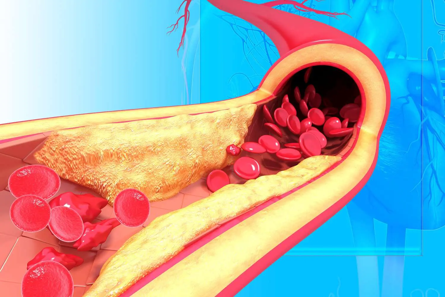 How To Lower Your Cholesterol Levels